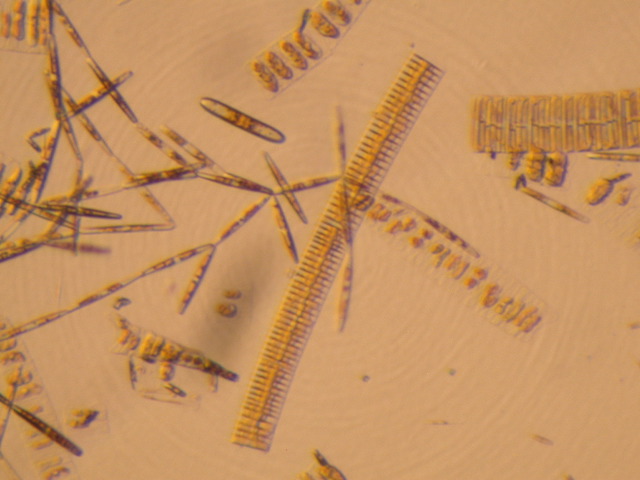 Ice Diatoms: chain forming Fragilariopsis (center), ribbons of Amphiprora (squares with oval centers), and colonies of Nitzschia (long ovals growing end-to-end)